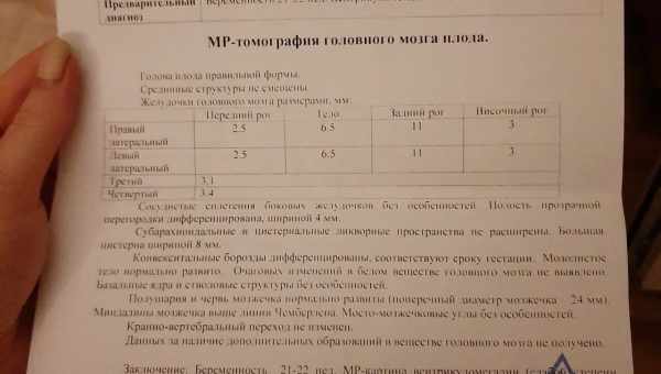 Таблица размеров боковых желудочков головного мозга в норме у плода по неделям, причины и последствия отклонений