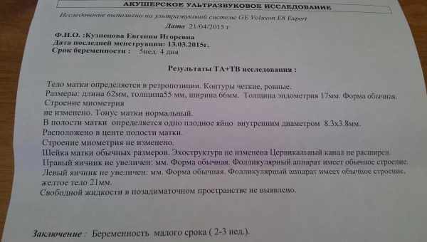 Можно женщине ли есть перед УЗИ при беременности: рекомендации специалистов