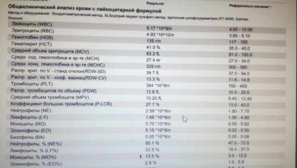 Пониженные лимфоциты в крови у ребенка – о чем это говорит и каковы причины показателей меньше нормы?