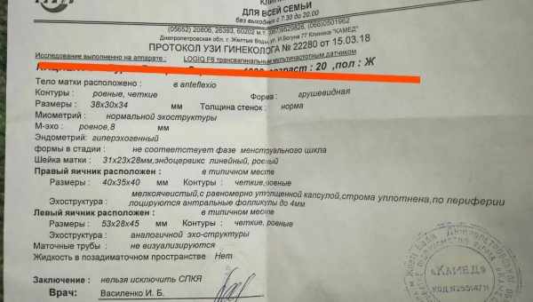 Причины гипоплазии почки у ребенка, симптомы патологии и способы лечения