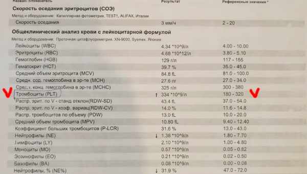 Что такое АСЛО в крови, каковы нормы этого показателя у детей и что показывает его повышение?