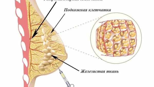 Как подтянуть грудь после кормления