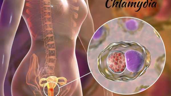 Лечение урогенитального хламидиоза при помощи метациклина