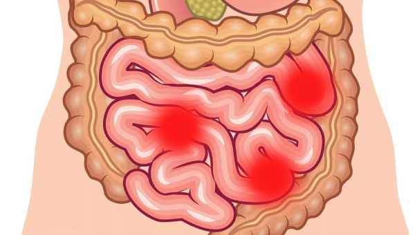 Боль в кишечнике при заболеваниях тонкой кишки