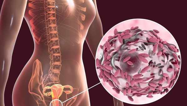 Гарднереллез - заболевание, передающееся половым путем
